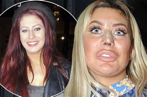 chloe ferry transformation|chloe ferry bum surgery.